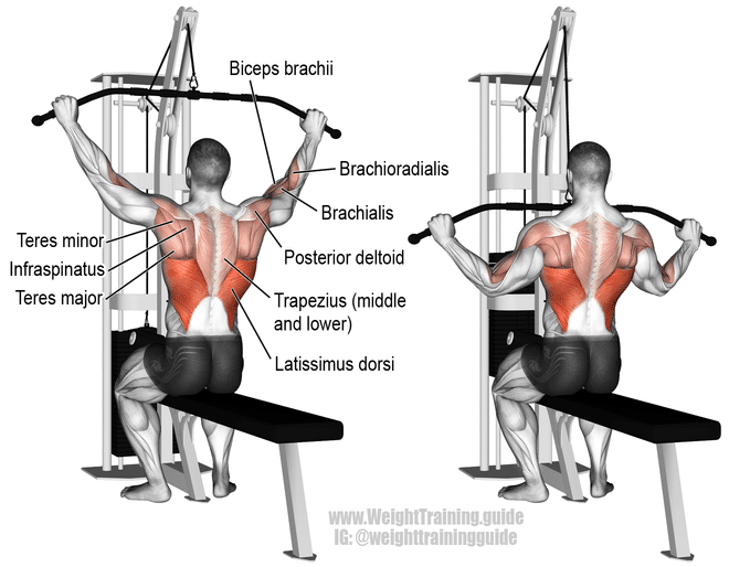 Lateral pull down example